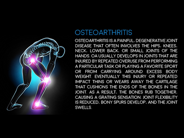 Osteoarthritis